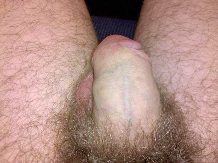 Photo of a penis from skinb