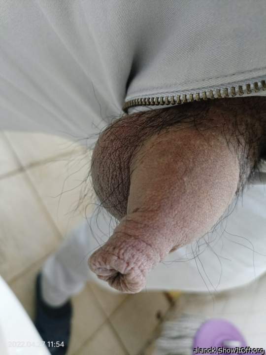 amazing foreskin 