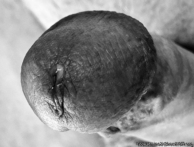 Glans Closeup; Leaking Meatus