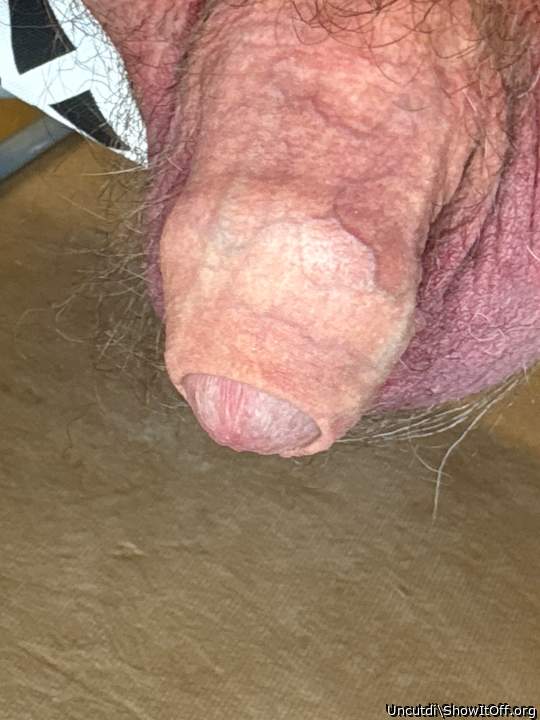 Photo of a penile from Uncutdi