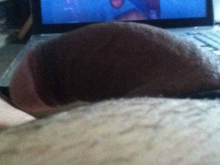 Photo of a middle leg from oralwerk
