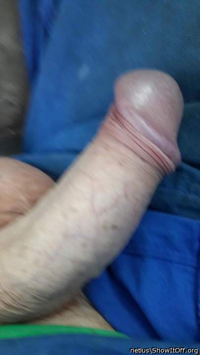 Beautiful, nasty foreskin!!!!    