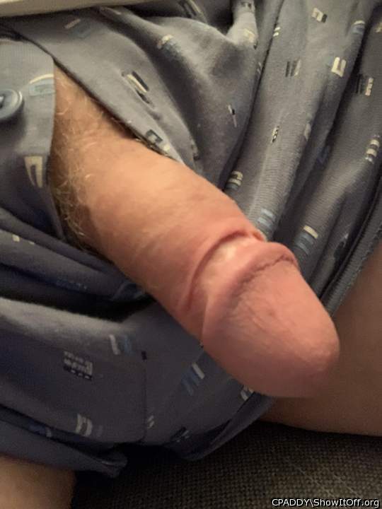 My Circumcised Dick-Do you like it?