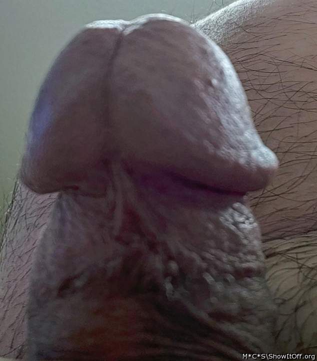 Photo of a short leg from M*C*S