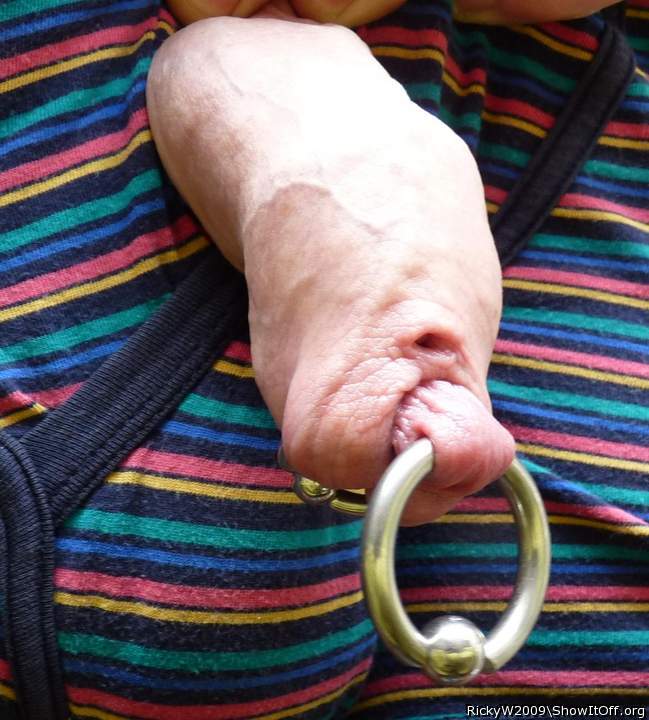 Inner foreskin ring