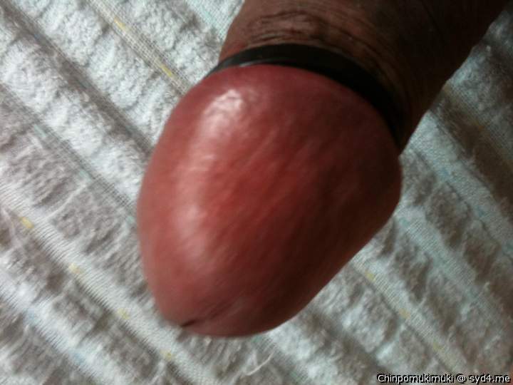 Photo of a private part from ChinpoMukimuki