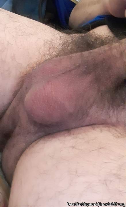 Testicles Photo from DeadEndSperm