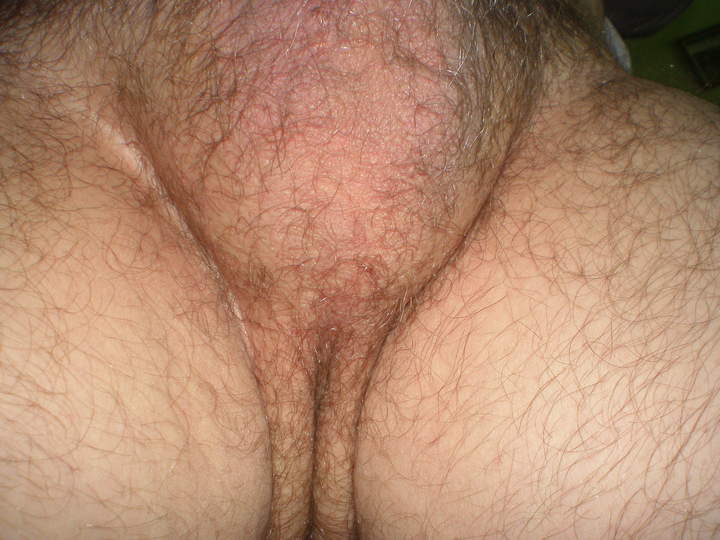 Testicles Photo from botanic