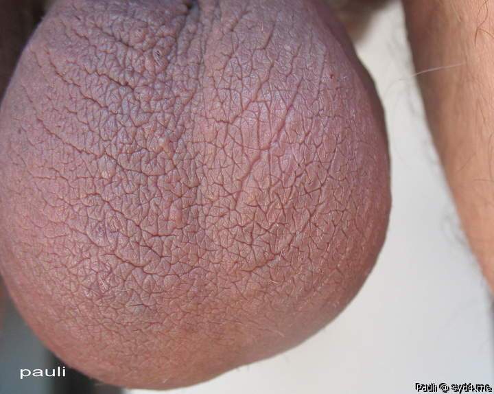 Ballbag wrinkles