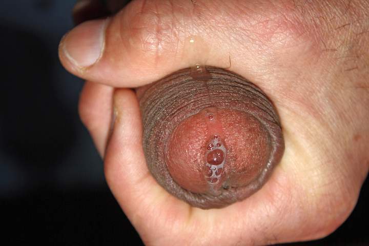 Photo of a private part from Anass