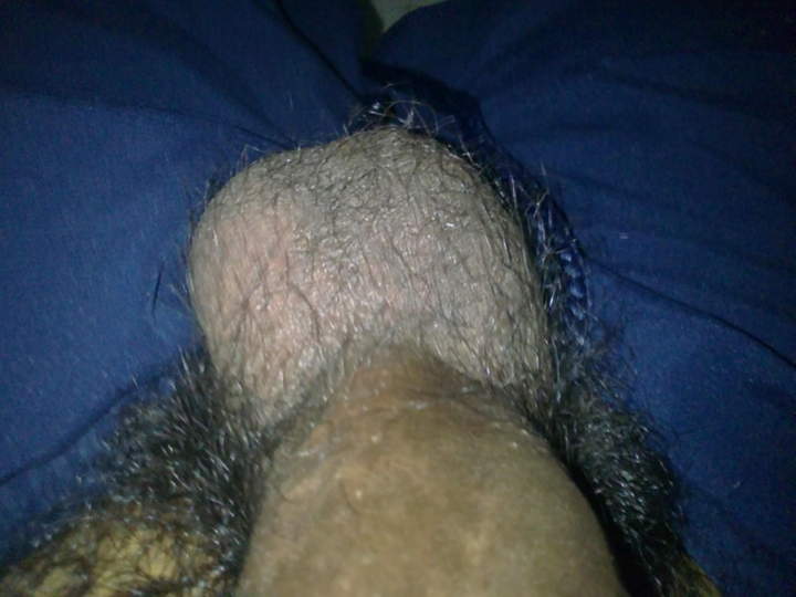 hairy balls...lol