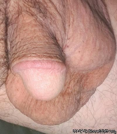 Photo of a middle leg from M*C*S