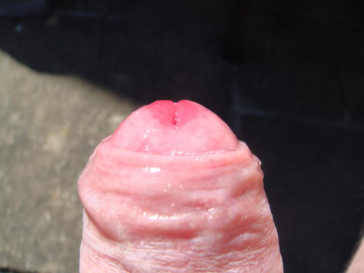 Photo of a prick from sivad666