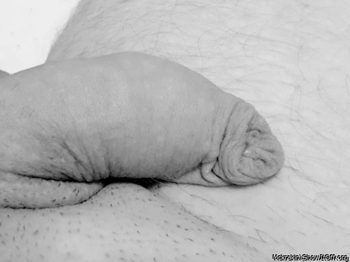 foreskin?