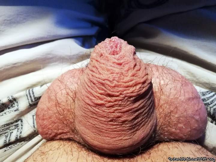 wrinkled foreskin