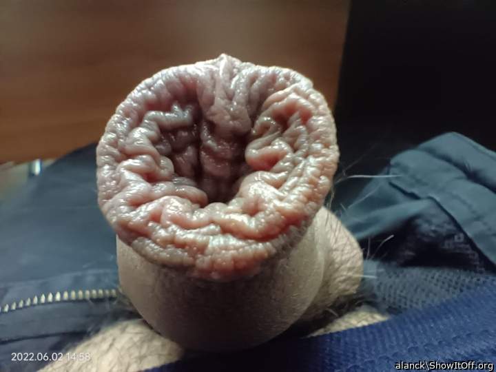 hot foreskin!    &#128069;