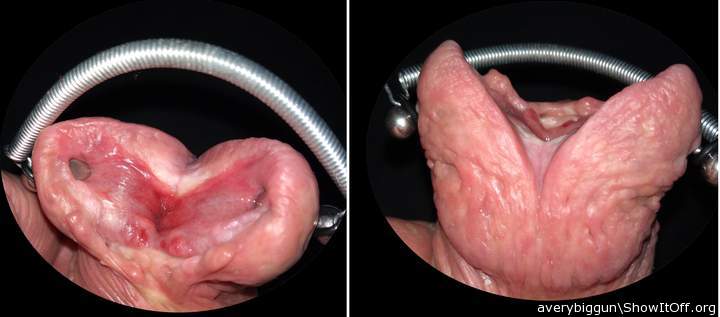 Spread Head