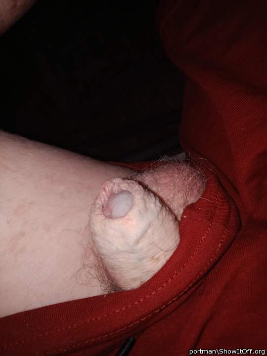 Foreskin