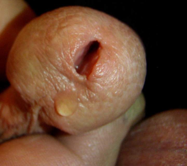 Lick, lick, lick....