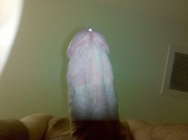 Photo of a shaft from skinb