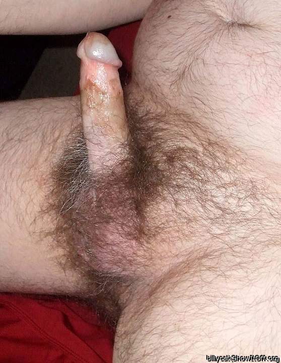 Magnificent hard-on with interesting circ scar and all that 