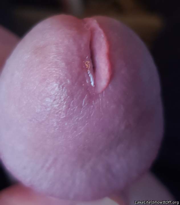 Photo of a middle leg from LakeLife
