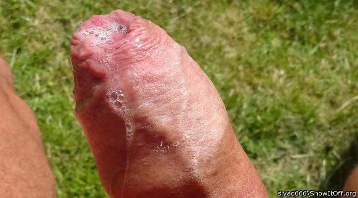 Your foreskin is so beautiful!  I would love to nibble at it