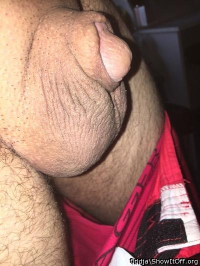  beautiful foreskin  are you not circumcised???