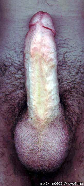 Photo of a short leg from mx3xrm0602
