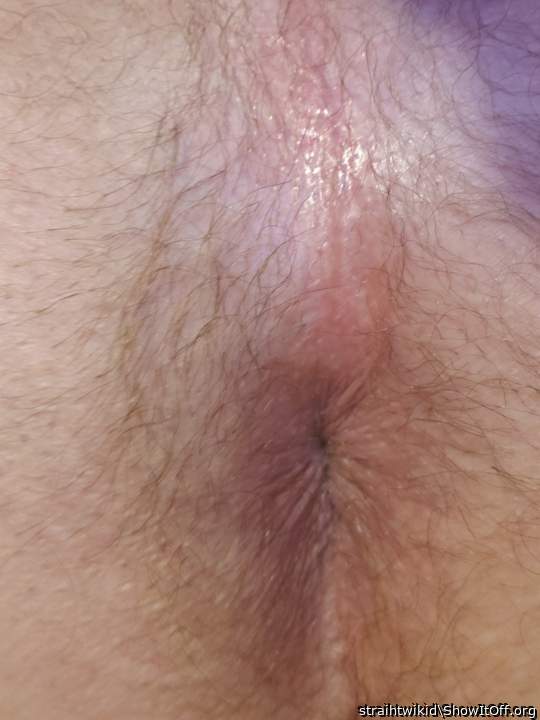 was asked to post a pic of my "ass ring" well here ya go enjoy