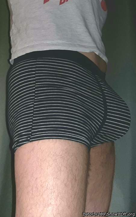 Photo of a short leg from batorbro89