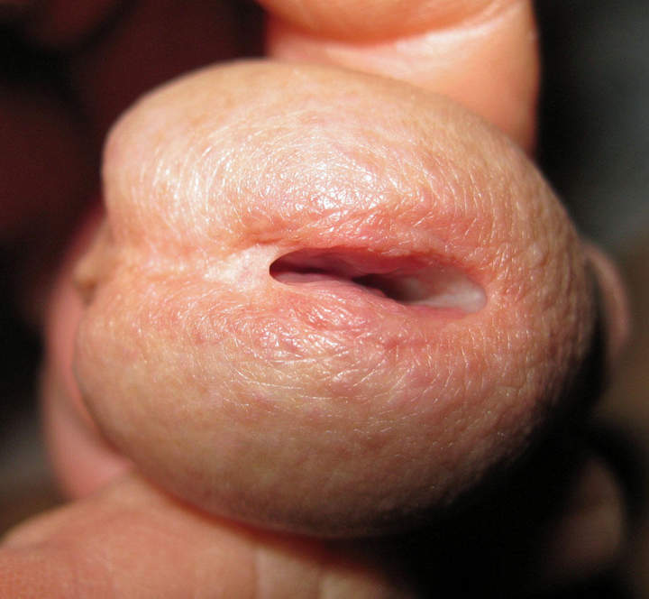 Cock-slit closeup.....