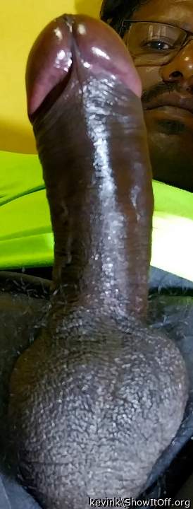 Photo of a penile from kevink