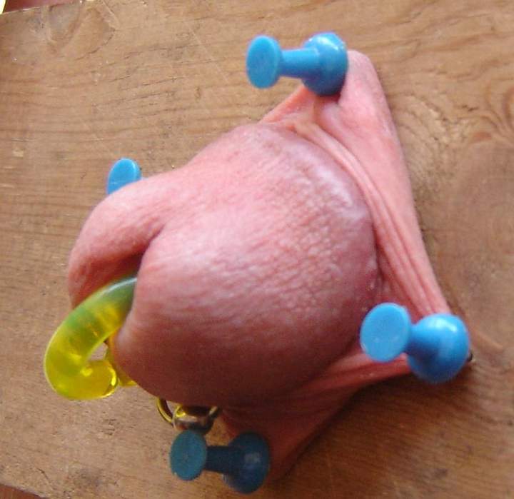 Foreskin pegged out