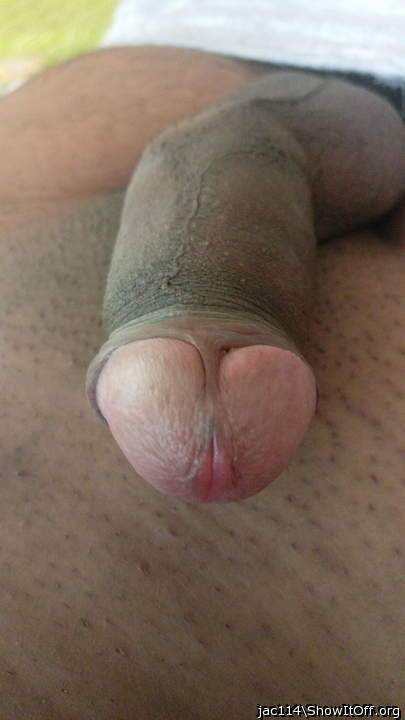 Photo of a prick from jac114