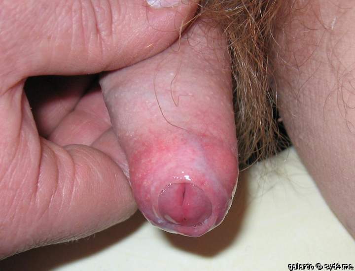 Pre cum