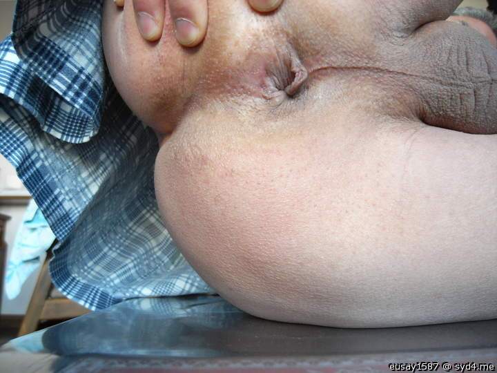 Fascinating hole   