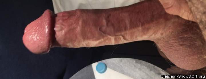 Photo of a penile from oneman