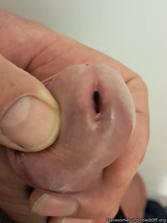 Photo of a short leg from Havesomefun