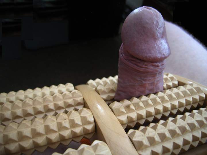 Photo of a prick from greenbelt