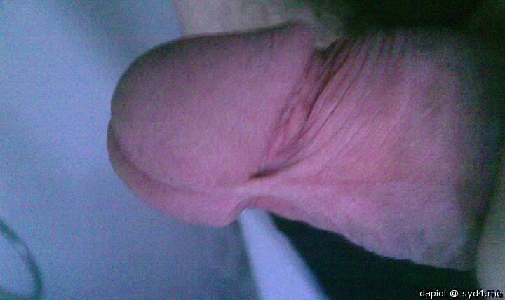 Photo of a bald-headed mouse from dapiol