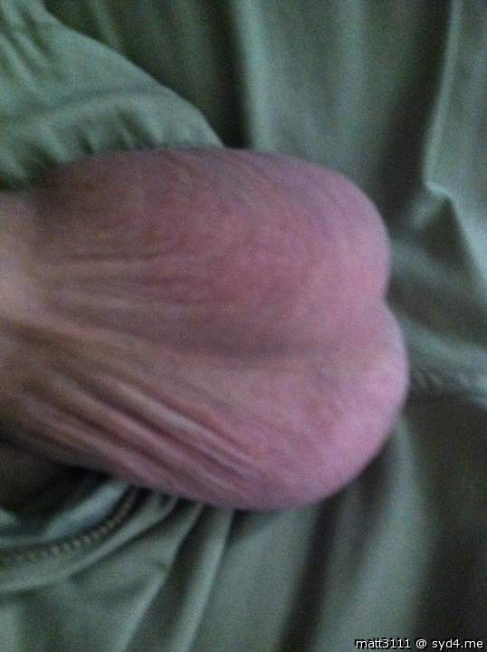 Testicles Photo from Matt3111