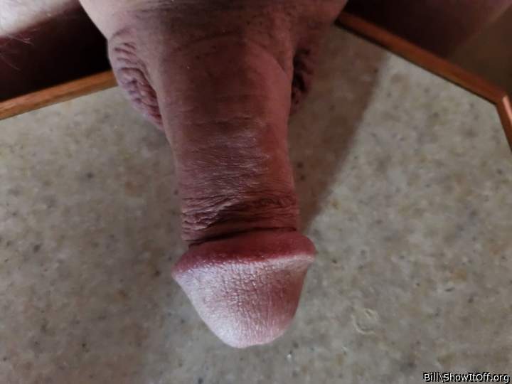 Foreskin removed, beautiful glans.   