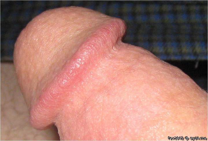 My Penis Head