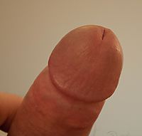 My Head
