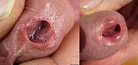 dick image