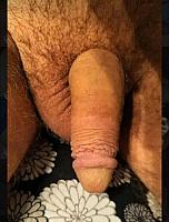 penis photo