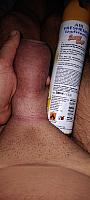 image of a penis