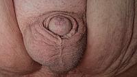 image of a penis