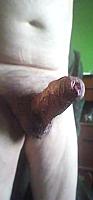 penile